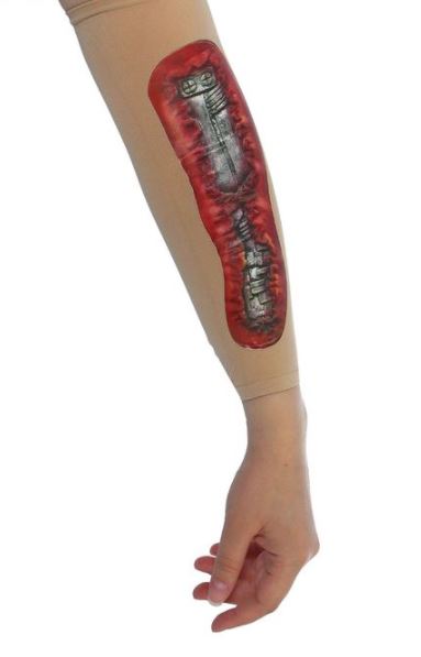 8787-31 Рана на руку Штырь(рукав) напрокат и купить в Казани по низкой оптовой цене, доставка по всей России